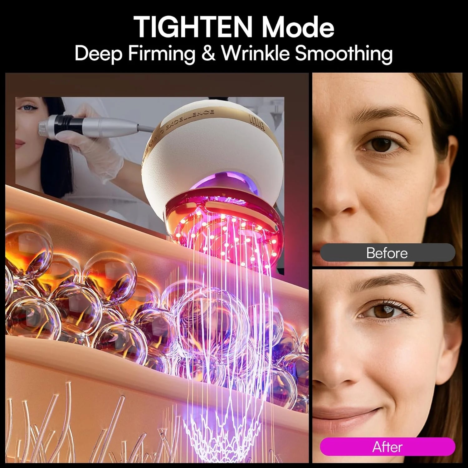 INIA SPHERA Upgraded 8-in-1 Microcurrent Facial Device for Face & Neck Red Light