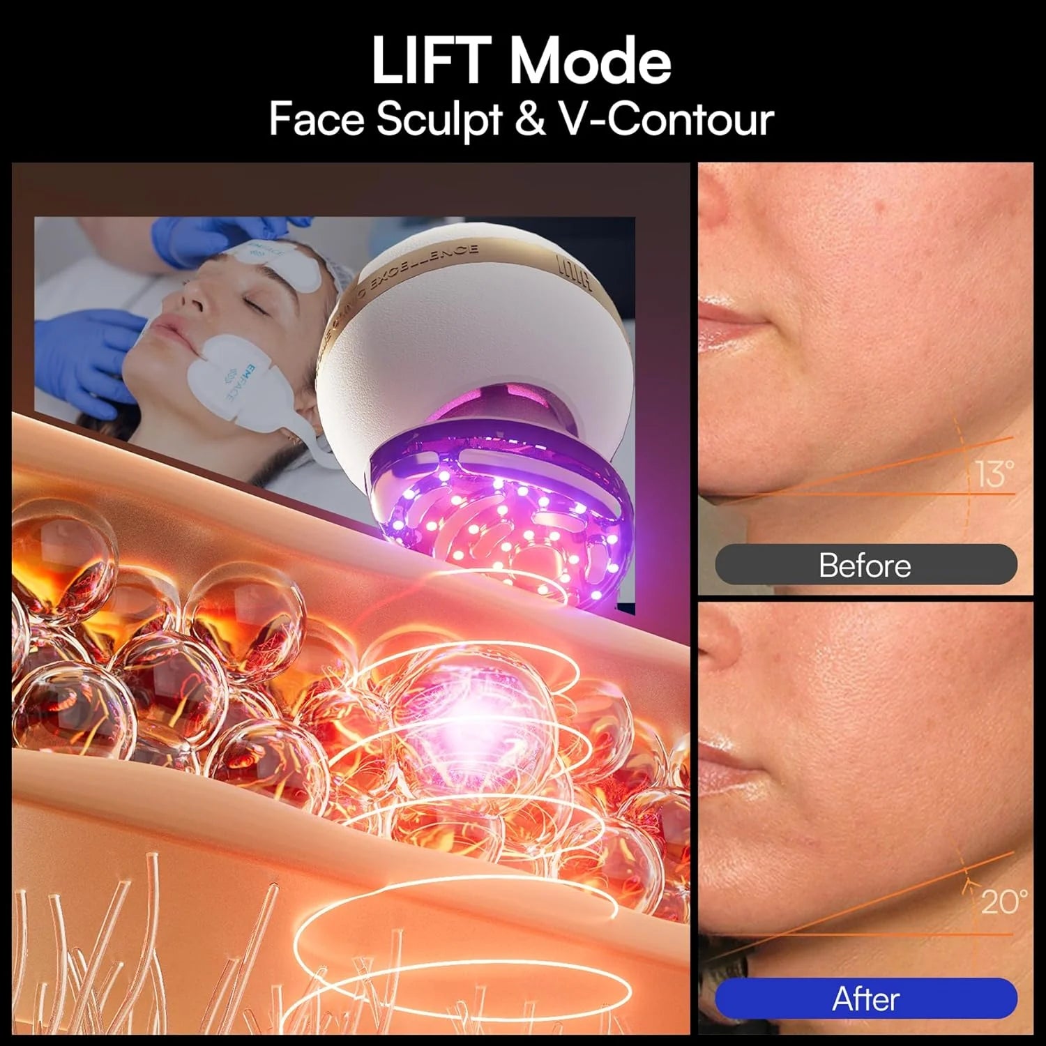 INIA SPHERA Upgraded 8-in-1 Microcurrent Facial Device for Face & Neck Red Light