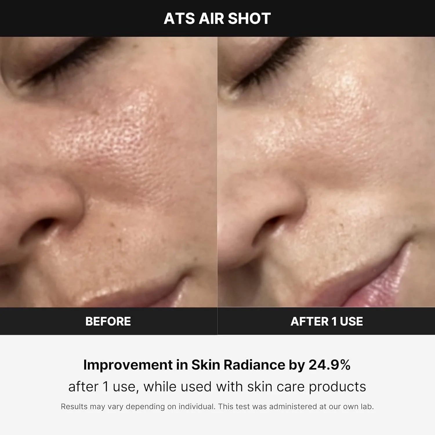 Medicube Age-R ATS Air Shot - Microneedling Pore Tightening Skin Care Device