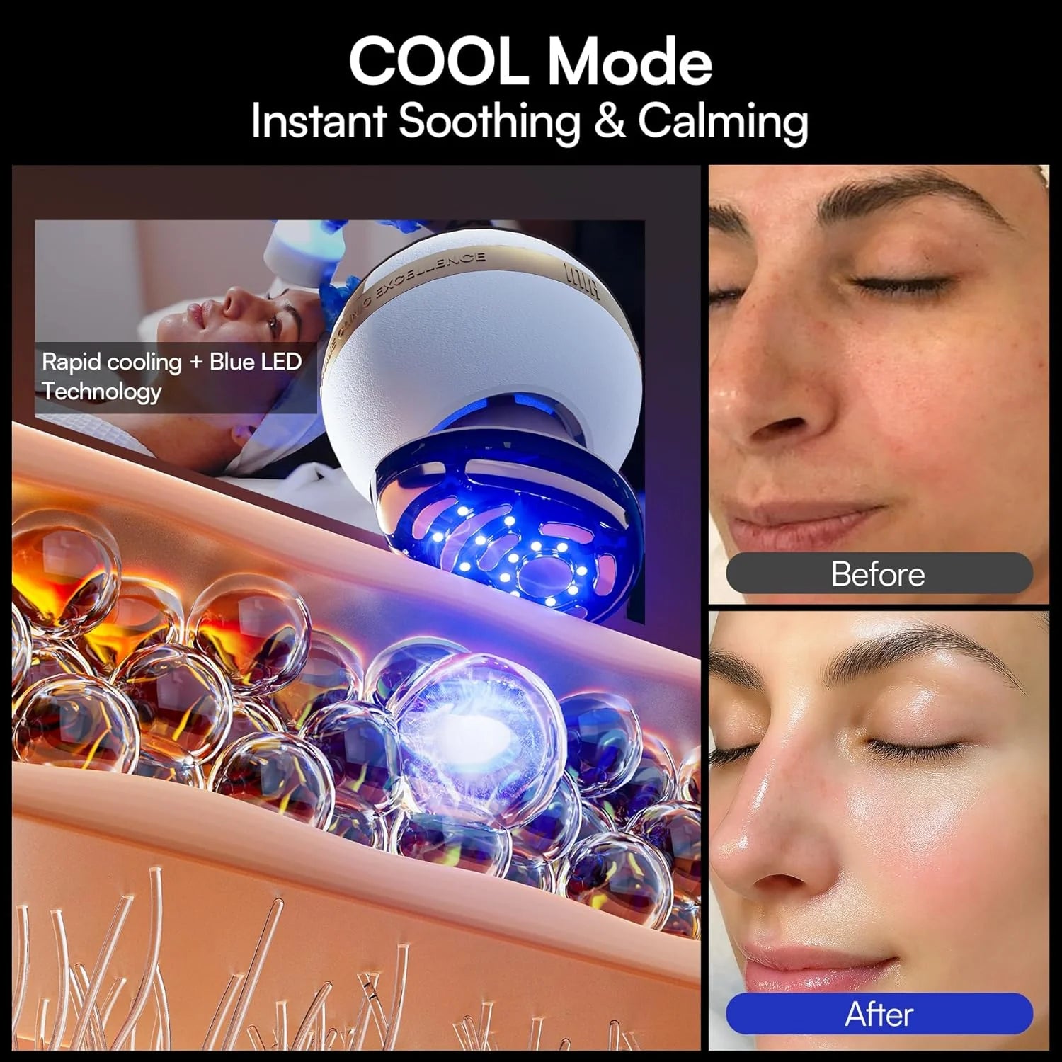 INIA SPHERA Upgraded 8-in-1 Microcurrent Facial Device for Face & Neck Red Light