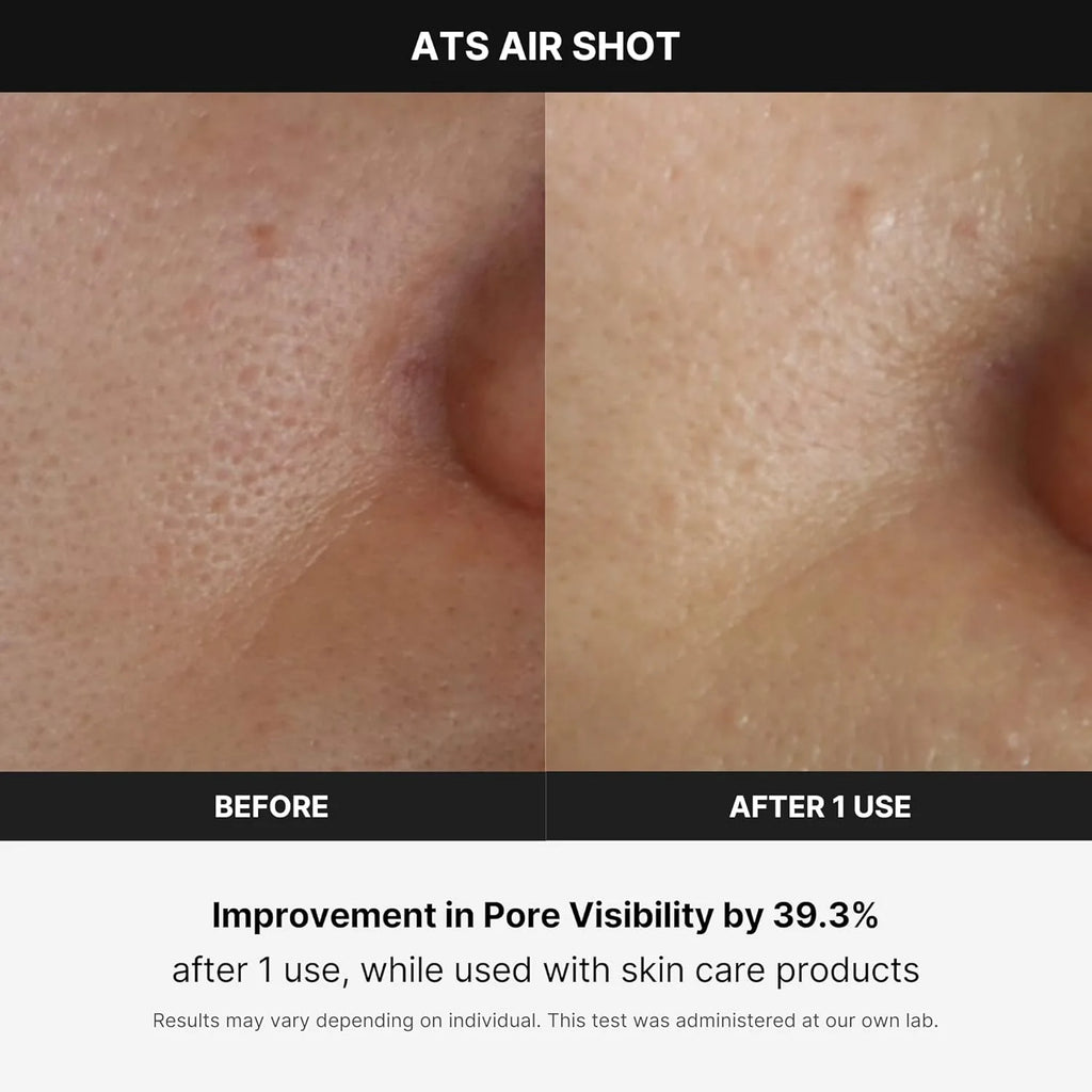 Medicube Age-R ATS Air Shot - Microneedling Pore Tightening Skin Care Device