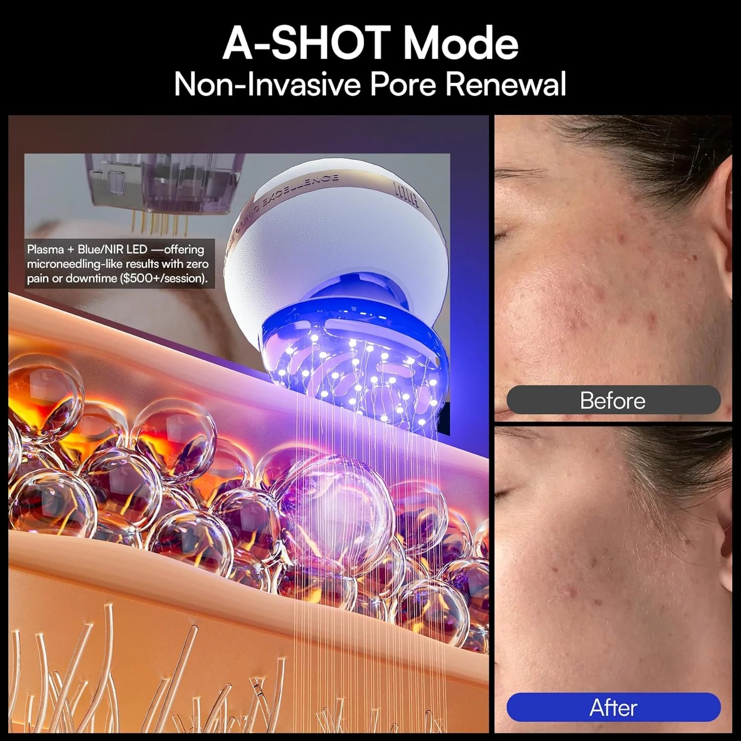 INIA SPHERA Upgraded 8-in-1 Microcurrent Facial Device for Face & Neck Red Light