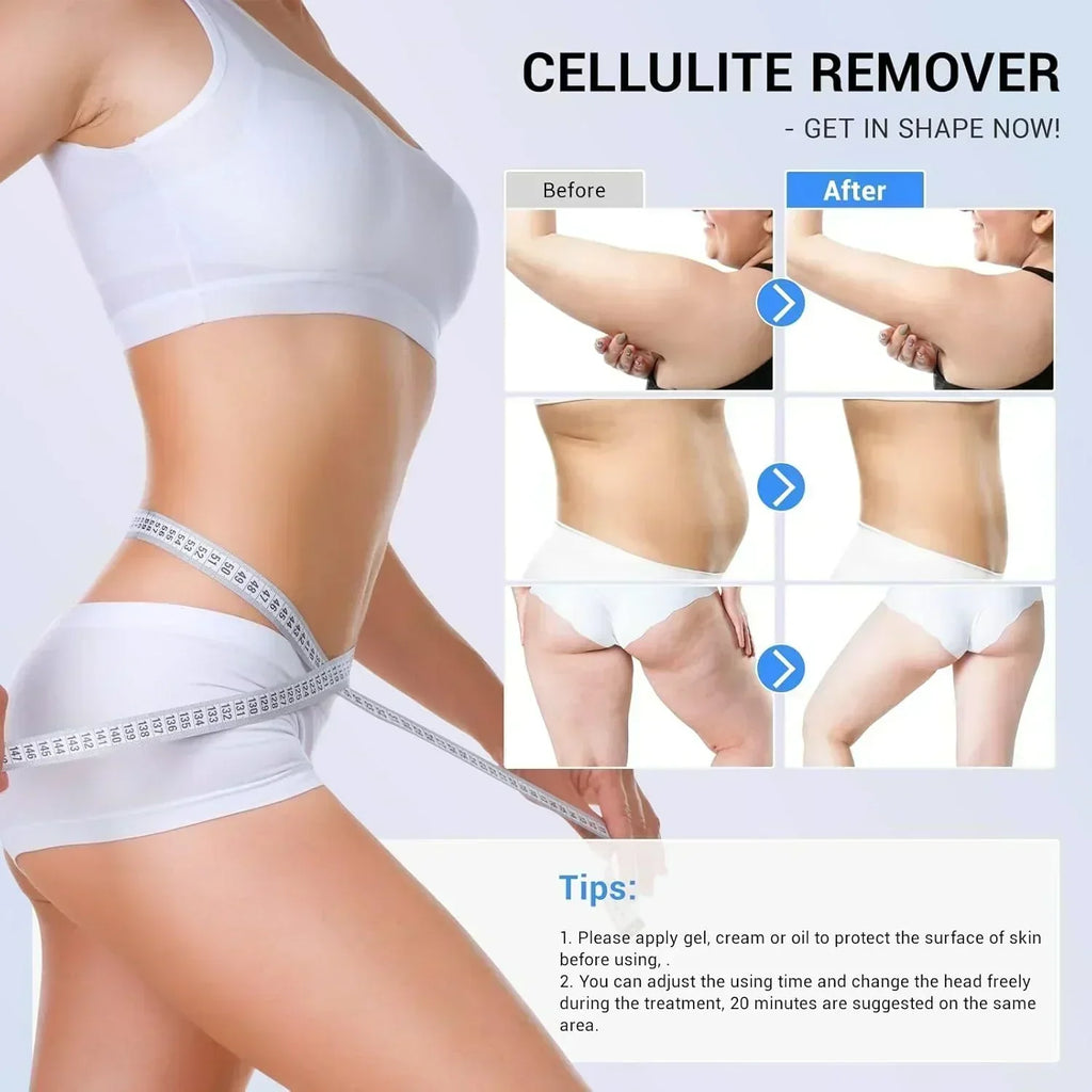 Improvement in The Appearance of Cellulite Device Cellulite Massager Radio Frequency Home Use
